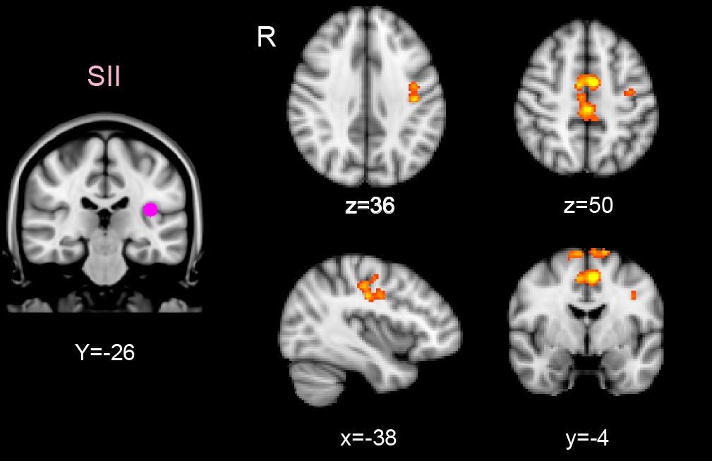 Sensory
                  Plasticity Research